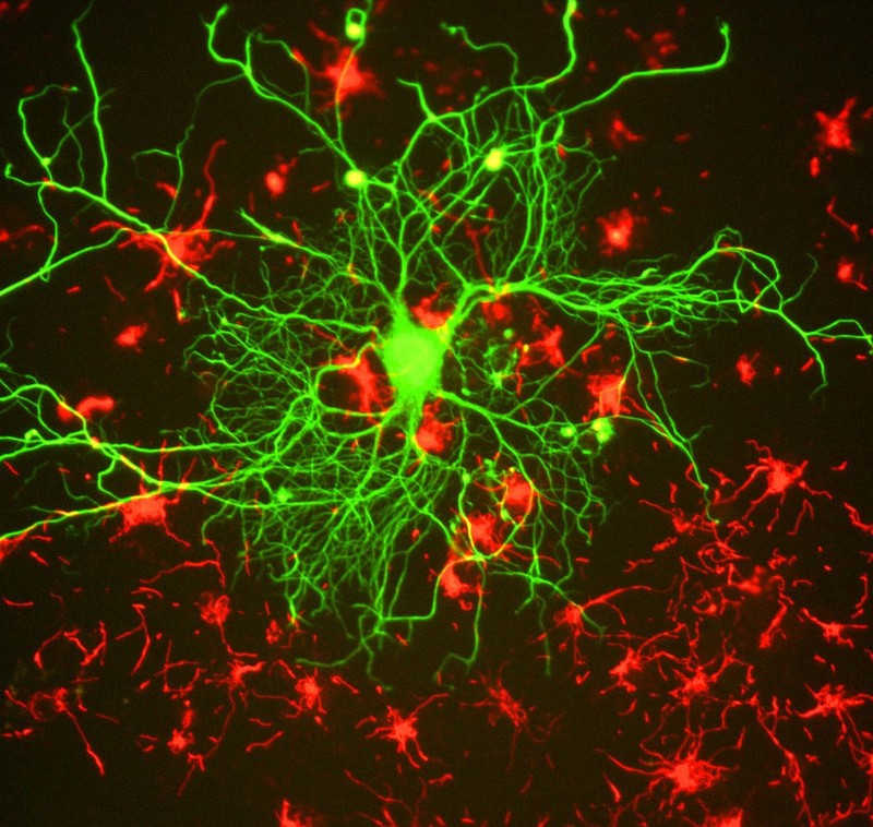 Cortical neuron tissue Cortical neuron tissue